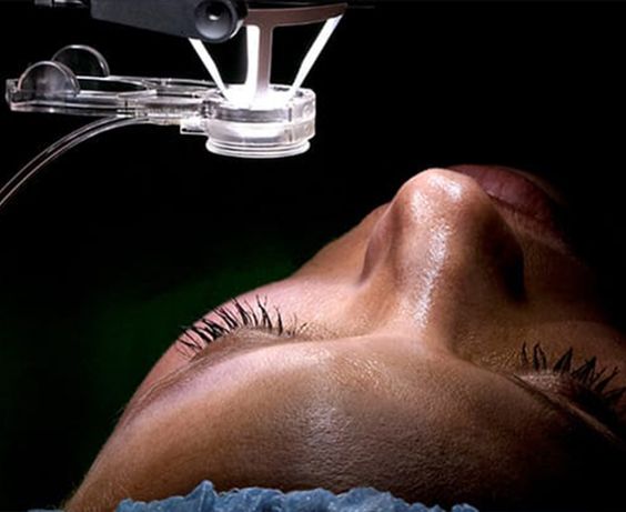 LASIK Eye Surgery: Pros and Cons